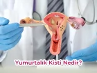 Yumurtalık Kisti Tedavisi: Kapsamlı Rehber ve Güncel Yaklaşımlar